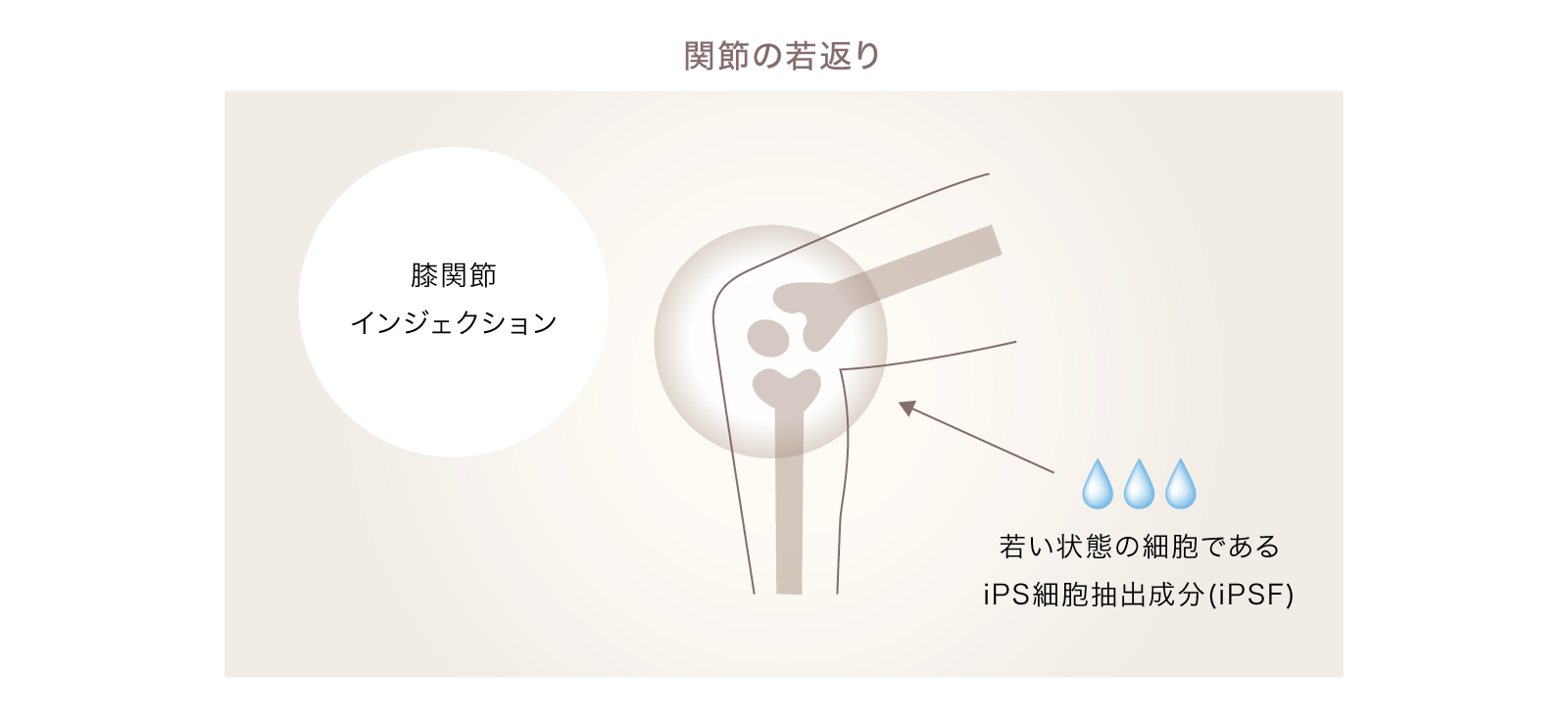 関節の若返り